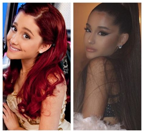 Ponytail Lift Surgery, Ariana Grande Plastic Surgery, Ponytail Lift, Big Ponytail, Then Vs Now, Brow Lift, Lip Injections, Nose Job, Dangerous Woman