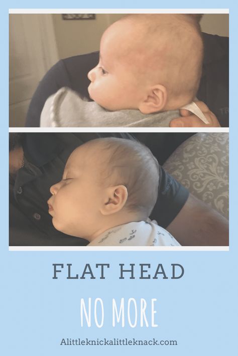 Aren't Heads Supposed To Be Round? What To Do If You Notice Your Baby Is Getting a Flat Head #plagiocephaly #brachycephaly Background Birds, Flat Head Pillow, Flat Head Baby, Baby Remedies, 2 Month Old Baby, 4 Month Old Baby, 2 Months Old, 3 Month Old Baby, 3 Month Baby