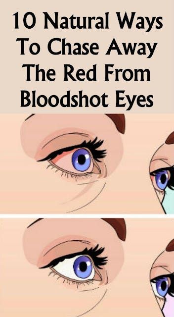 Red Eyes Remedy, Beginner Eyeshadow, Bloodshot Eyes, Lip Color Makeup, Body Organs, Tired Eyes, Lack Of Sleep, Chronic Fatigue, Eye Bags