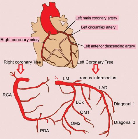 Cath Lab Nursing, Arteries Anatomy, Cardiac Sonography, Cardiology Nursing, Coronary Artery, Nurse Study Notes, Nursing Mnemonics, Medical Student Study, Cardiac Nursing