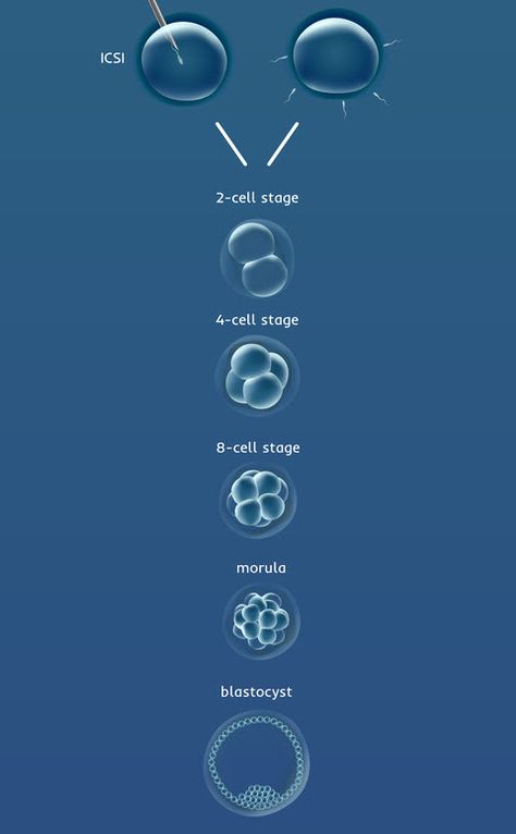 Embryo Development, Ivf Procedure, Ivf Baby, Ivf Cycle, Embryo Transfer, In Vitro Fertilization, In Vitro, Biology Notes, Human Anatomy And Physiology