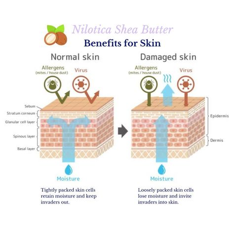 Due to its anti-inflammatory, antioxidant, antibacterial, and collagen-boosting properties, Nilotica Shea butter has the ability to soothe dryness, eczema, and other skin conditions. #violetbotanical #violetbodyme #niloticashea #niloticasheabutter #sheabutterproducts #sheabutterbenefits #sheabuttercream #nomoredryskin #eczemarelief #dryskinrelief #moisturizedskin #healthyskinessentials Shea Butter Benefits, Botanical Skincare, Body Butters, Bath And Body Care, Healthy Skin Care, Skin Conditions, Body Butter, Body Skin Care, Dry Skin