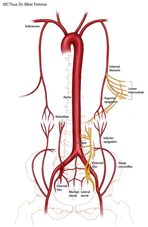 Arteries Anatomy, Superior Mesenteric Artery, Abdominal Aorta, Mri Brain, Doctor Advice, Medical School Studying, Health And Fitness Magazine, Ct Scan, Healthy Diet Tips