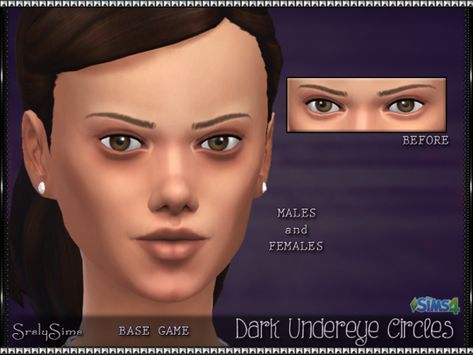 Sims 4 Cc Medieval, Dark Circles Remedies, The Sims 4 Mods Cc, Dark Spots Under Eyes, Ultimate Decades Challenge, Dark Undereyes, Dark Undereye, Dark Circles Around Eyes, Dark Circle Remedies