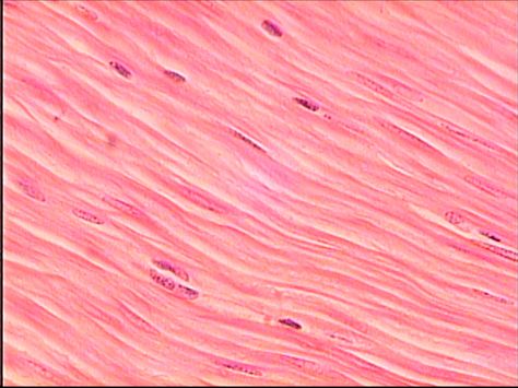 Muscle Cell, Cardiac Muscle, Anatomy Humor, Smooth Muscle Tissue, Histology Slides, Smooth Muscle, Under Microscope, Science Printables, Human Tissue