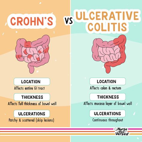 ⭐️ Crohn's vs. Ulcerative Colitis   Inflammatory Bowel Disease (IBD) primarily includes two conditions: Crohn's Disease and Ulcerative Colitis, and understanding the differences between the two as a nursing student is key  🟢 Crohn's Disease:  → Affects entire GI tract → Affects full thickness of bowel wall → Ulcerations can be patchy and scattered (skip lesions)  🔵 Ulcerative Colitis:  → Affects colon and rectum → Affects mucosal layer of bowel wall → Ulcerations are continuous throughout Immunity Nursing, Nursing School Studying Cheat Sheets, Medical Assistant Student, Nursing School Essential, Inflammatory Bowel, Medicine Notes, Medical School Life, Nursing School Motivation, Nurse Study Notes