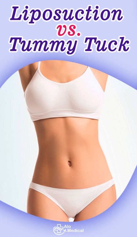 Abdominal Lipo Before And After, Stomach Lipo Before And After, Lipo Before And After, Confidence Level, Smart Casual Work Outfit, Fat Belly, Skin Tags, Abdominal Fat, Best Hospitals