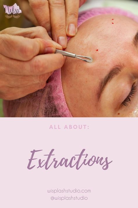 Aesthetician Studio, Extractions Facial, Facial Extractions, Huge Pimple, Facial Esthetician, How To Do Facial, Pimple Removal, Facial Procedure, Snohomish Washington