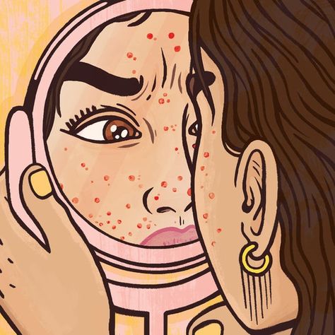 7 Struggles Everyone With Acne-Prone Skin Understands Girl With Acne, Skin Clearing, Bad Acne, Face Acne, Magnifying Mirror, Love Your Skin, Acne Skin, Powder Foundation, Makeup Foundation