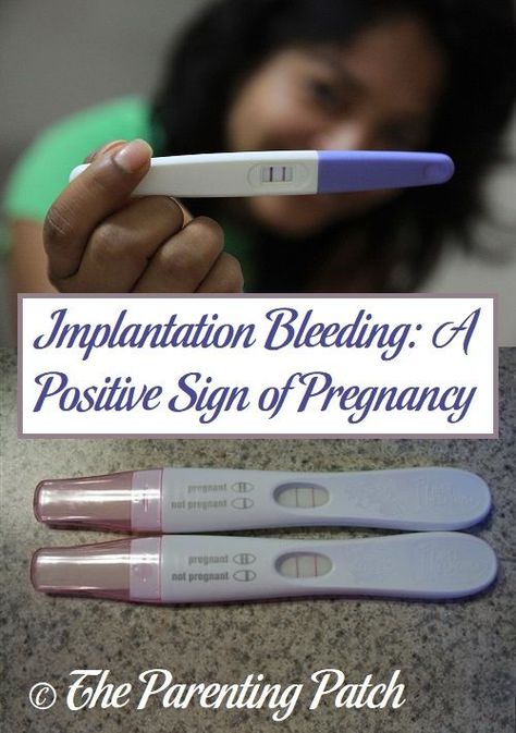 Although spotting during pregnancy often causes fear, implantation bleeding is a positive sign of pregnancy for many women. via @ParentingPatch Sign Of Pregnancy, Spotting During Pregnancy, Invitro Fertilization, Early Pregnancy Signs, Ectopic Pregnancy, Positive Pregnancy Test, Pregnancy Labor, Pregnancy Hormones, Fallopian Tubes