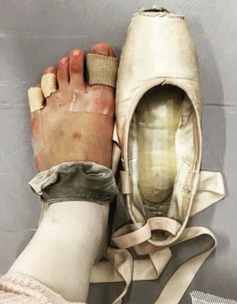 Dancer Lifestyle, Ballet Beauty, No Pain No Gain, Blood Art, Ballerina Dancing, Pretty Ballerinas, Pointe Shoes, Ap Art, Ballet Slippers