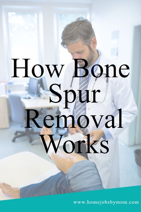 What's Bone Spur Removal? A technique to help reduce chronic pain & improve mobility. Find out more today! #BoneSpurRemoval #Surgery #Health Heal Spurs, Improve Mobility, Neck Bones, Physical Therapy Exercises, Body Hair Removal, Body Healing, Health Knowledge, Home Jobs, Medical Conditions