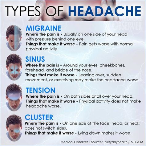 Types of Headaces to be aware of! Types Of Headaches Chart, Exam Notes, Natural Headache, Headache Types, Essential Oils For Headaches, Chronic Migraines, Migraine Relief, Tension Headache, Headache Relief