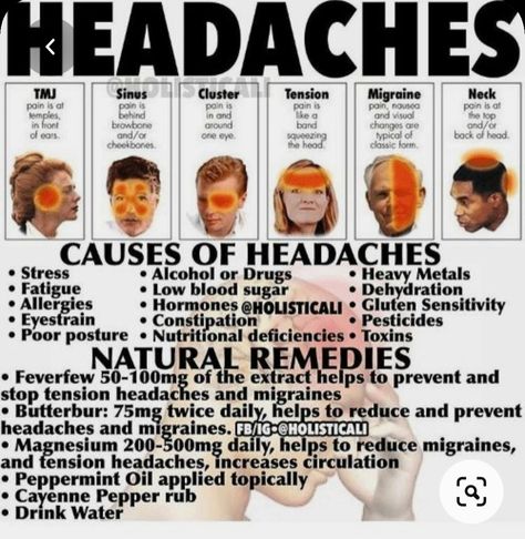 Dating A Gemini, Tension Migraine, Headache Types, Natural Headache Remedies, Migraine Relief, Tension Headache, Migraine Headaches, Natural Therapy, Natural Health Remedies