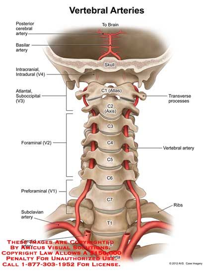 Punkty Spustowe, Vertebral Artery, Gross Anatomy, Medical Student Study, Brain Anatomy, Human Body Anatomy, Spine Health, Muscle Anatomy, Human Anatomy And Physiology