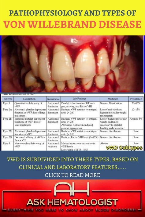 Von Willebrand Disease, Normal Distribution, Disease