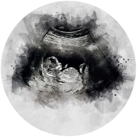 40 First Mother’s Day Gifts That Celebrate New and Expectant Moms Ultrasound Art, Vom Avea Un Copil, Baby Ultrasound, Wal Art, Art For Wall, Foto Baby, Watercolor Effects, Pregnancy Gifts, First Art