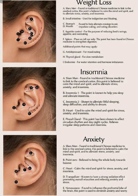 Holistic Ear Piercings, Ear Accupunture Points, Ear Acupuncture Chart, Ear Pressure Points Piercing, Reflexology For Migraines, Queer Ear Piercing, Ear Piercings For Health, Migraine Piercing Health, Acupuncture Ear Seeds