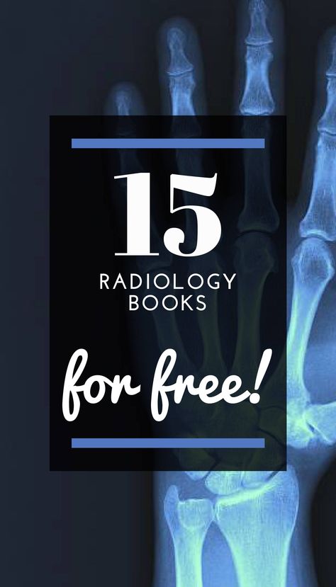 Looking for Radiology books to read for free? It's your lucky day! In this post we give you more than 15 books about Radiology that you can read completely free and download in PDF format! #infoboks #freebooks #pdfbooks #downloadbooks #Radiologybooks #Radiology Interventional Radiology Technologist, Radiology Student Study Tips, Radiology Student Must Haves, Interventional Radiology Nurse, Radiography Student Aesthetic, X Ray Tech Student, Radiography Aesthetic, Radiology Student Study, Radiology Student Wallpaper