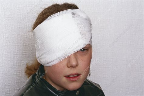 Bandaged eye - Stock Image - M526/0199 - Science Photo Library Carl Grimes, Science Photos, Yandere Simulator, Model Release, Photo Library, Eye Drawing, An Eye, Costume Design, Stock Images