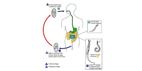 Enterobiasis Nursing Management, Communicable Diseases, Response To Intervention, Nursing Assessment, Nursing Diagnosis, Nurse Manager, Nursing Care Plan, Teaching Plan, Medication Management
