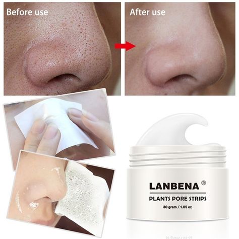 Nose Peeling, Nose Pore Strips, Black Head Remover Mask, Nose Pores, Peeling Mask, Pore Strips, Nose Mask, Get Rid Of Blackheads, Peel Off Mask