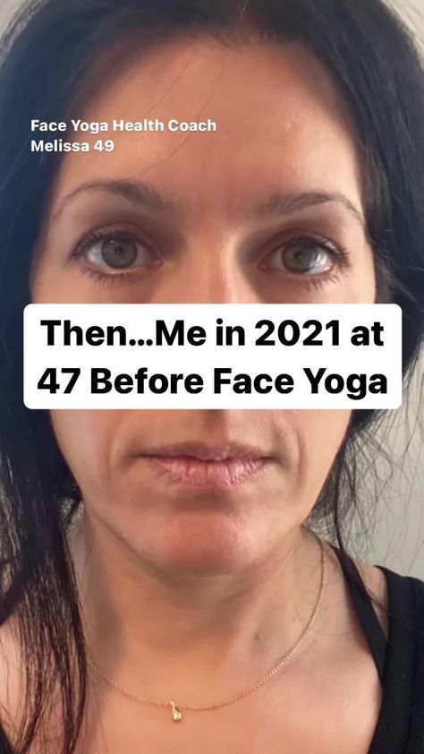 Exercises For Turkey Neck Face Yoga, Face Yoga For Smile Lines, Face Yoga For Marionette Lines, Face Yoga Turkey Neck, Face Yoga For Laugh Lines, Age Naturally, Medicine Tips, Aging Backwards, Out Of My League