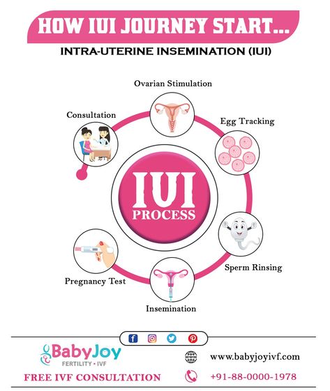 Iui Fertility Diet, In Vitro Fertilization Process, Future Midwife, Iui Procedure, Fertilization Process, Dr Post, Fibroid Diet, Pregnant Tips, Getting Pregnant Tips