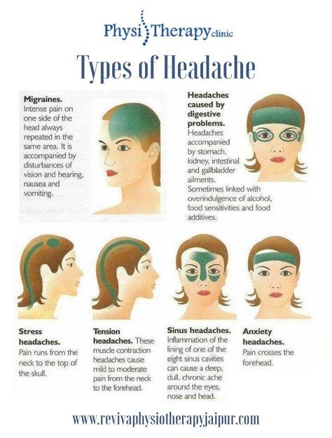 Many of us are familiar with some form of the throbbing, uncomfortable, and distracting pain of a headache. There are different types of headaches. Different Types Of Headaches, Bolesti Chrbta, Headache Types, Reiki Meditation, Migraine Relief, Headache Relief, Migraine Headaches, Medical Knowledge, Health Info