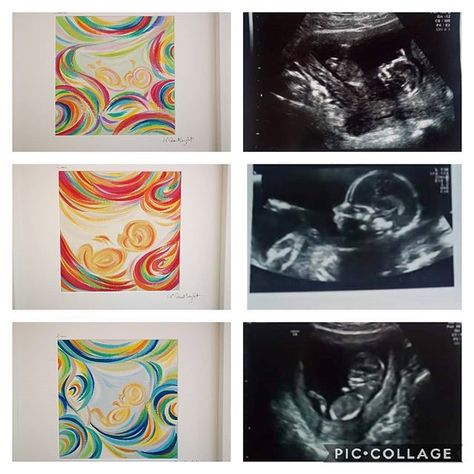 No photo description available. Diy Nursery Art, Colorful Canvas Paintings, Mother Painting, Birth Art, Baby Ultrasound, Baby Canvas, Pregnancy Art, Biology Art, Trippy Painting