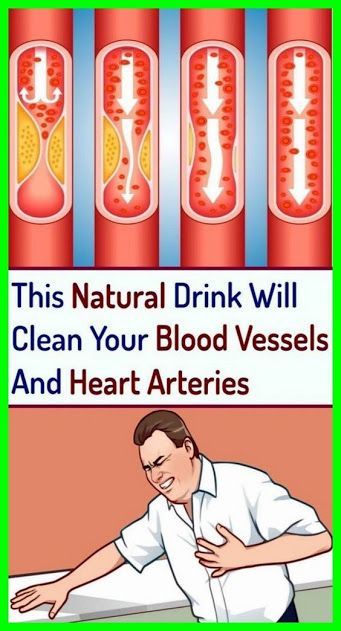 Board name Heart Arteries, Clogged Arteries, Coconut Health Benefits, Benefits Of Coconut Oil, Natural Drinks, Health Advice, Blood Vessels, Healthy Tips, Way Of Life