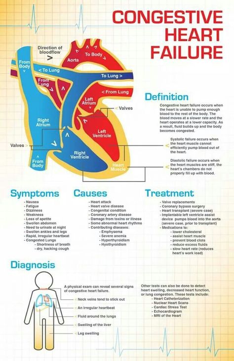 Congestive heart failure Emt Study, Nursing Information, Penyakit Jantung, Cardiac Nursing, Nursing School Studying, Nursing School Tips, Nursing School Notes, Student Nurse, Medical Coding