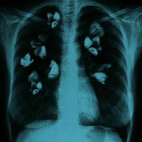 X Rays Aesthetic, Dark Eerie Aesthetic, Ray Core Aesthetic, Mothcore Aesthetic, X Ray Butterfly, Raycore Aesthetic, Antidote Aesthetic, Gothic Love Aesthetic, X Ray Aesthetic