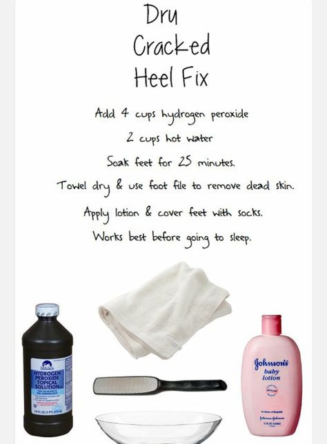 DIY how to get rid of cracked feet Dry Cracked Heels, Cracked Heel, Cracked Heels, Beauty Remedies, Hydrogen Peroxide, Homemade Beauty Products, Health And Beauty Tips, Beauty Treatments, Simple Tricks