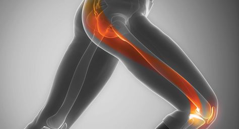 IT Band Syndrome: The Cause (and Solution!) Pain down the outside of your leg?  It’s a sign something’s not working right. Pain, contrary to popular belief, is your friend – it’s your body’s way of signaling to you that something needs your attention. One of the most common causes of knee, hip and outer-thigh pain […] #ITBandSyndrome, #ITBS, #Running, #SportsChiropractic It Band Symptoms, Outer Thigh Stretch, It Band Stretches Knee Pain, Thigh Muscle Pain, It Band Pain, Tight It Band, Tensor Fasciae Latae, Outer Thigh Workout, Patellofemoral Pain Syndrome