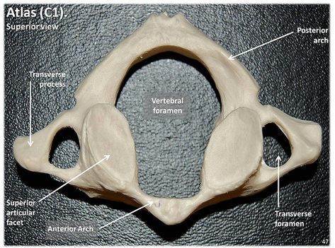 Atlas C1 vertebra, superior view with labels - Axial Skeleton Visual Atlas, page 47 | by Rob Swatski Bony Landmarks, Axial Skeleton, Physical Therapy School, Dance Workout Routine, Anatomy Bones, Skeleton Anatomy, Spinal Surgery, Nursing School Studying, Medical School Essentials