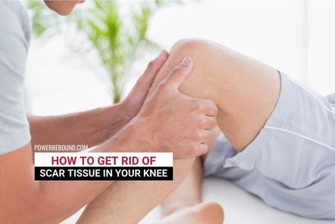 Scar Tissue Massage, Knee Replacement Surgery Recovery, Healthy Knees, Knee Replacement Exercises, Knee Replacement Recovery, Knee Surgery Recovery, Knee Operation, Getting Rid Of Scars, How To Break Up