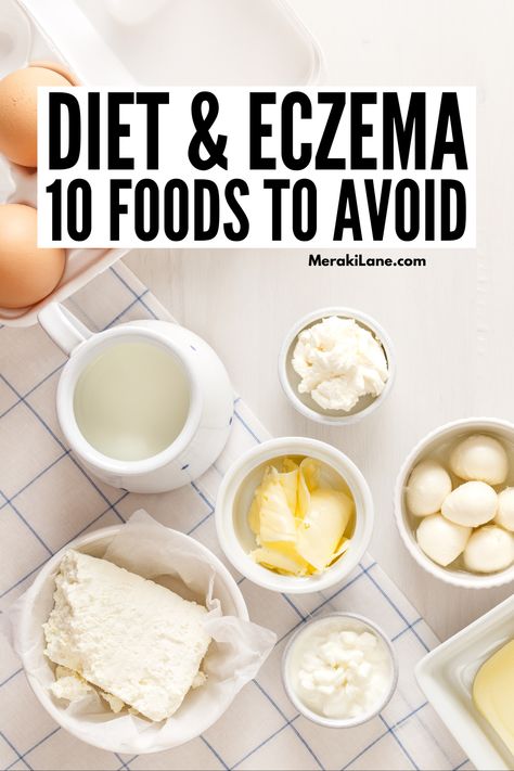 Eat This Not That: 10 Worst Foods for Eczema Sufferers Ezcema Diet, Eat This Not That, Bad Food, No Dairy Recipes, Reduce Food Waste, Foods To Avoid, Foods To Eat, Food App, Food Allergies