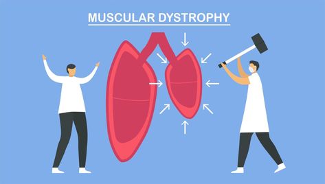 Muscular dystrophy is diseases Duchenne Muscular Dystrophy, Muscular Dystrophy, Room Art, Art Room, Vector Art, Disease, Clip Art, Quick Saves, Art