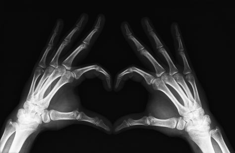 X-Ray Heart by ~mmattes on deviantART - very cool. Radiology Humor, Rad Tech Week, Radiologic Technology, Xray Art, X-ray Images, Photographie Indie, Radiology Tech, Fb Cover Photos, Xray Tech