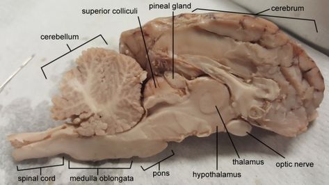 Dissection Anatomy, Brain Dissection, Brain Diagram, Skull Anatomy, Medicine Studies, Vet Medicine, Basic Anatomy And Physiology, Brain Facts, Medical Student Study