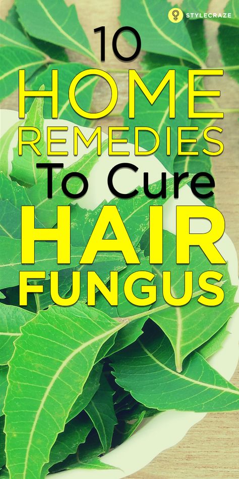 Scalp Fungus, Fungal Infection Remedies, Skin Fungus, Thick Hair Remedies, Skin Moles, Laser Eye, Hair Remedies For Growth, Eye Surgery, Hair Remedies