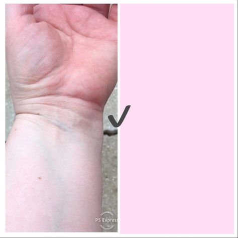 Blue Veins Skin Tone, Blue Veins, Green Veins, Color Analysis, Pink Colour, Pale Skin, The Skin, Colour Palette, Skin Tone