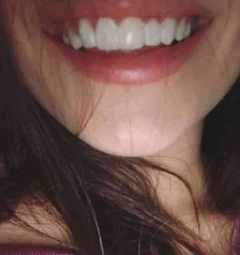 Teeth Aesthetic, Pretty Teeth, Beautiful Teeth, Straight Teeth, Perfect Teeth, Teeth Whitening Strips, Smile Teeth, Life Vision Board, White Smile