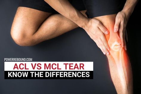 ACL vs MCL Tear: Know the Differences Mcl Injury, Bad Knee Workout, Fascia Lata, Middle Back Pain, Acl Tear, Knee Replacement Surgery, Stomach Ulcers, Best Cardio Workout, Knee Surgery