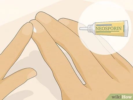 How to Get Rid of Hangnails: 10 Steps (with Pictures) - wikiHow Nail Remedies, Sick Remedies, Orange Stick, Diy Nails At Home, Cuticle Nipper, Nail Studio, Mani Pedi, Nail Artist, Diy Beauty