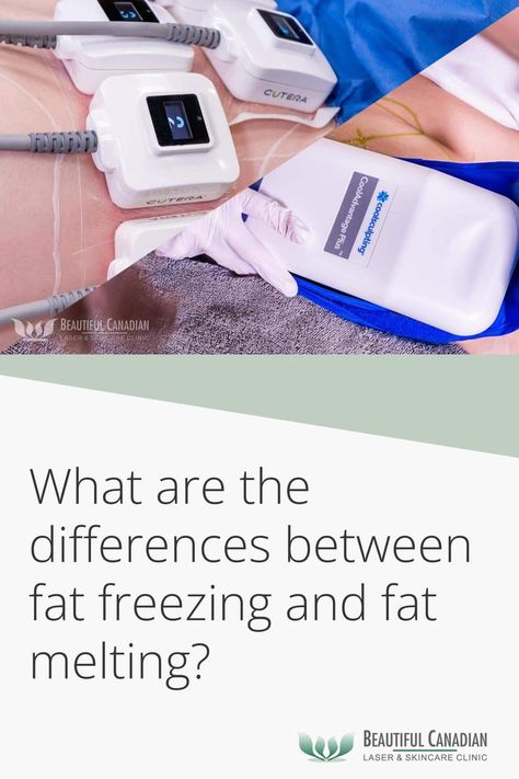 Fat cells die with heat, like they do with freezing temperatures. So what are the differences between fat freezing and fat melting? There are four to know. Laser Fat Removal, Fat Freezing, Melt Belly Fat, Visceral Fat, Cool Sculpting, Diy Drinks, Fat Removal, Organic Health, Foods To Avoid