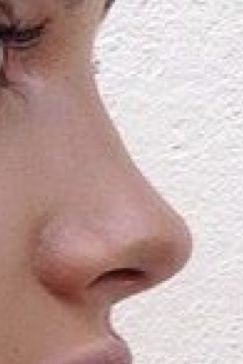 Pretty Nose Shape Front View, Perfect Nose Shape, Ideal Nose, Smooth Nose, Sharp Nose, Pointy Nose, Upturned Nose, Beautiful Nose, Cute Nose