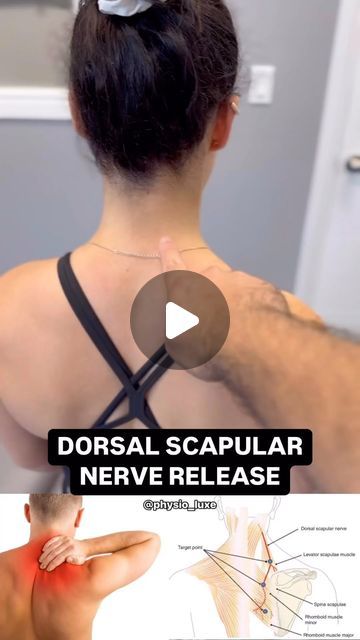 Pulled Neck Muscle, Knots In Neck Muscle, Pinched Nerve In Shoulder, Muscle Spasms Relief, Shoulder Pain Remedies, Pinched Nerve In Neck, Shoulder Blade Muscles, Levator Scapulae, Shoulder Muscle Pain