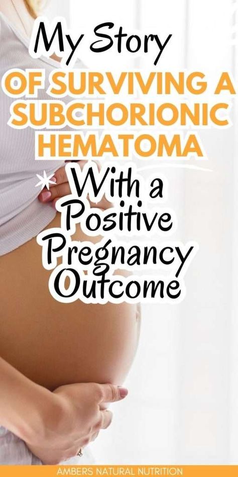 This is my story of surviving a subchorionic hematoma with a positive outcome. I want to give hope to other moms who have a subchorionic hematoma because I had a subchorionic hematoma that threatened my pregnancy. Luckily I had a positive subchorionic hematoma pregnancy outcome. Hyperemesis Gravidarum Remedies, Hemorrhage After Birth, Hyperemesis Gravidarum Awareness, Subchorionic Hemorrhage, Pregnancy Prayer, Ectopic Pregnancy, Give Hope, This Is My Story, First Trimester